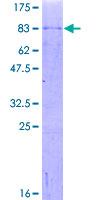 CRTR1 / TFCP2L1 Protein - 12.5% SDS-PAGE of human TFCP2L1 stained with Coomassie Blue