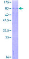 CRTR1 / TFCP2L1 Protein - 12.5% SDS-PAGE of human TFCP2L1 stained with Coomassie Blue
