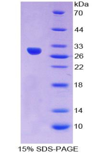 CRY Protein - Recombinant Crystallin Lambda 1 By SDS-PAGE