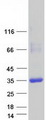 CRY Protein - Purified recombinant protein CRYL1 was analyzed by SDS-PAGE gel and Coomassie Blue Staining