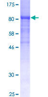 CRY1 Protein - 12.5% SDS-PAGE of human CRY1 stained with Coomassie Blue