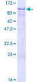 CRY2 Protein - 12.5% SDS-PAGE of human CRY2 stained with Coomassie Blue