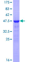 CRYAA / Alpha A Crystallin Protein - 12.5% SDS-PAGE of human CRYAA stained with Coomassie Blue