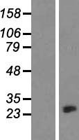 CRYBA1 Protein - Western validation with an anti-DDK antibody * L: Control HEK293 lysate R: Over-expression lysate