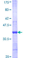 CRYBA1 Protein - 12.5% SDS-PAGE Stained with Coomassie Blue.