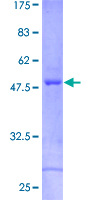 CRYBA2 Protein - 12.5% SDS-PAGE of human CRYBA2 stained with Coomassie Blue
