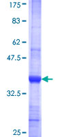 CRYBA4 Protein - 12.5% SDS-PAGE Stained with Coomassie Blue.