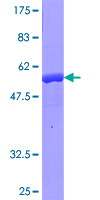 CRYBB1 Protein - 12.5% SDS-PAGE of human CRYBB1 stained with Coomassie Blue