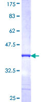 CRYBB1 Protein - 12.5% SDS-PAGE Stained with Coomassie Blue.