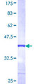 CRYBB1 Protein - 12.5% SDS-PAGE Stained with Coomassie Blue.