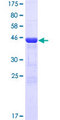 CRYBB2 Protein - 12.5% SDS-PAGE of human CRYBB2 stained with Coomassie Blue