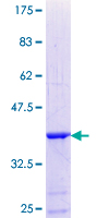 CRYBB3 Protein - 12.5% SDS-PAGE Stained with Coomassie Blue.