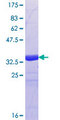CRYGB Protein - 12.5% SDS-PAGE Stained with Coomassie Blue.