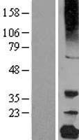 CRYGC / CCL Protein - Western validation with an anti-DDK antibody * L: Control HEK293 lysate R: Over-expression lysate