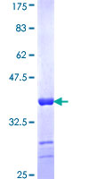 CRYGC / CCL Protein - 12.5% SDS-PAGE Stained with Coomassie Blue.