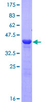 CRYGD / CCP Protein - 12.5% SDS-PAGE of human CRYGD stained with Coomassie Blue