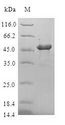 CRYGD / CCP Protein - (Tris-Glycine gel) Discontinuous SDS-PAGE (reduced) with 5% enrichment gel and 15% separation gel.