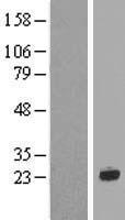 CRYGN Protein - Western validation with an anti-DDK antibody * L: Control HEK293 lysate R: Over-expression lysate