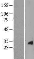 CRYGS Protein - Western validation with an anti-DDK antibody * L: Control HEK293 lysate R: Over-expression lysate
