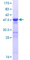 CRYGS Protein - 12.5% SDS-PAGE of human CRYGS stained with Coomassie Blue