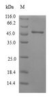 CRYGS Protein - (Tris-Glycine gel) Discontinuous SDS-PAGE (reduced) with 5% enrichment gel and 15% separation gel.