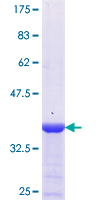 CRYGS Protein - 12.5% SDS-PAGE Stained with Coomassie Blue.