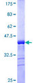 CRYM Protein - 12.5% SDS-PAGE Stained with Coomassie Blue.