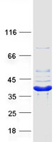 CRYM Protein - Purified recombinant protein CRYM was analyzed by SDS-PAGE gel and Coomassie Blue Staining