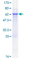 CRYZ Protein - 12.5% SDS-PAGE of human CRYZ stained with Coomassie Blue