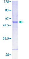 CS / Citrate Synthase Protein - 12.5% SDS-PAGE of human CS stained with Coomassie Blue