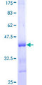 CS / Citrate Synthase Protein - 12.5% SDS-PAGE Stained with Coomassie Blue.