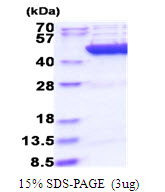 CS / Citrate Synthase Protein