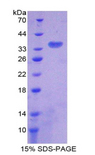 CS / Citrate Synthase Protein - Recombinant Citrate Synthase By SDS-PAGE