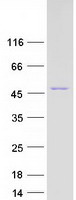 CS / Citrate Synthase Protein - Purified recombinant protein CS was analyzed by SDS-PAGE gel and Coomassie Blue Staining