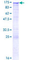 CS1 / CLSTN1 Protein - 12.5% SDS-PAGE of human CLSTN1 stained with Coomassie Blue