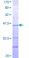CS1 / CLSTN1 Protein - 12.5% SDS-PAGE Stained with Coomassie Blue.
