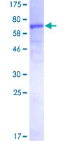 CSA / ERCC8 Protein - 12.5% SDS-PAGE of human ERCC8 stained with Coomassie Blue