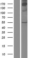 CSAD / CSD Protein - Western validation with an anti-DDK antibody * L: Control HEK293 lysate R: Over-expression lysate