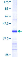 CSAD / CSD Protein - 12.5% SDS-PAGE Stained with Coomassie Blue.