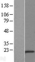 CSDC2 Protein - Western validation with an anti-DDK antibody * L: Control HEK293 lysate R: Over-expression lysate