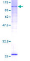 CSDE1 Protein - 12.5% SDS-PAGE Stained with Coomassie Blue.
