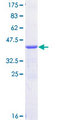 CSDE1 Protein - 12.5% SDS-PAGE Stained with Coomassie Blue