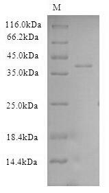 CSE1L Protein - (Tris-Glycine gel) Discontinuous SDS-PAGE (reduced) with 5% enrichment gel and 15% separation gel.