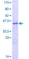 CSE1L Protein - 12.5% SDS-PAGE of human CSE1L stained with Coomassie Blue