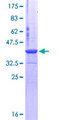 CSE1L Protein - 12.5% SDS-PAGE Stained with Coomassie Blue