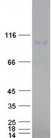 CSE1L Protein - Purified recombinant protein CSE1L was analyzed by SDS-PAGE gel and Coomassie Blue Staining
