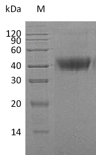CSF1 / MCSF Protein - (Tris-Glycine gel) Discontinuous SDS-PAGE (reduced) with 5% enrichment gel and 15% separation gel.