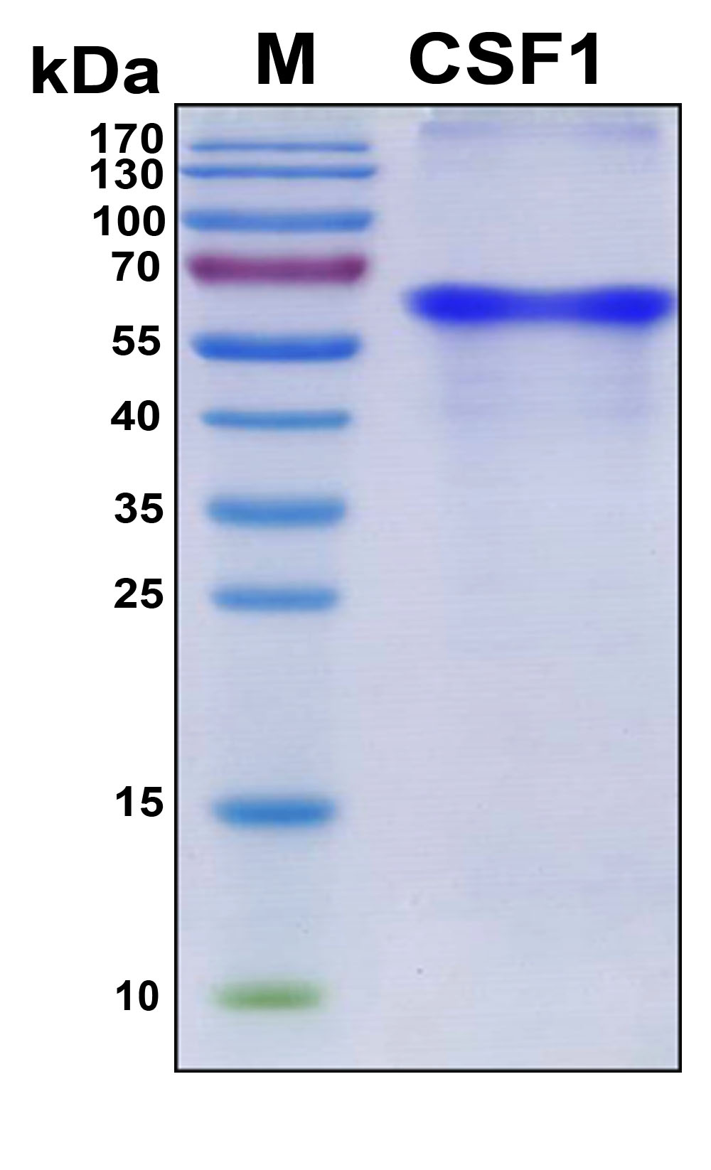 CSF1 / MCSF Protein - SDS-PAGE under reducing conditions and visualized by Coomassie blue staining