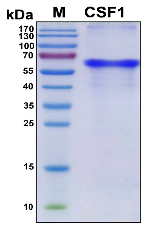 CSF1 / MCSF Protein - SDS-PAGE under reducing conditions and visualized by Coomassie blue staining
