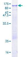 CSF1 / MCSF Protein - 12.5% SDS-PAGE of human CSF1 stained with Coomassie Blue